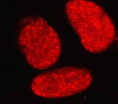 Anti-phospho-Nrf 2 (Ser40)