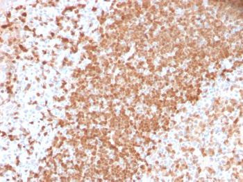 Anti-TCL1 (T-Cell Marker) Monoclonal Antibody (Clone: TCL1/2747R)
