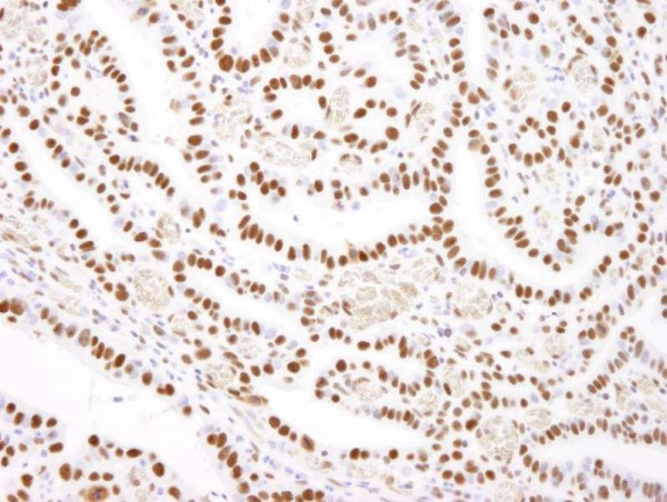 Anti-Nucleolin (NCL) (IHC)
