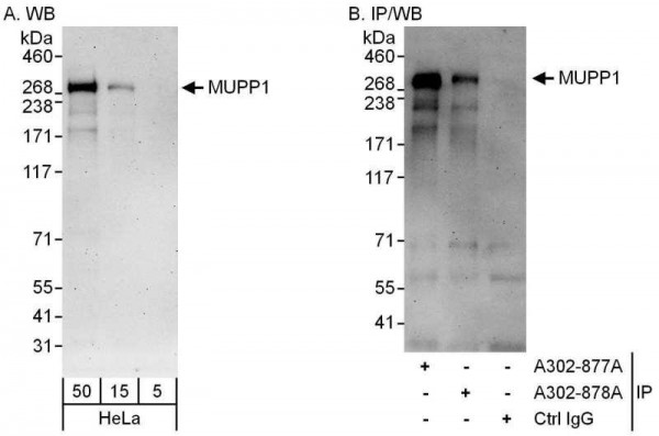 Anti-MUPP1
