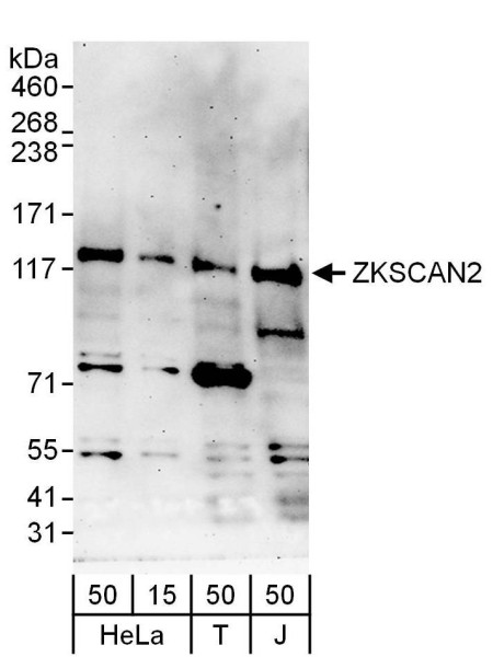 Anti-ZKSCAN2