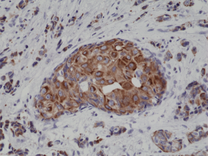 Anti-Cytokeratin-18 (human), Rabbit Monoclonal (RM279)