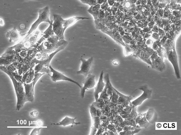 ASB-XIV Cells