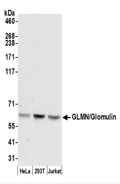 Anti-GLMN/Glomulin