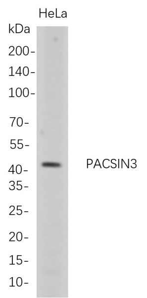 Anti-Recombinant PACSIN3, clone 9D5