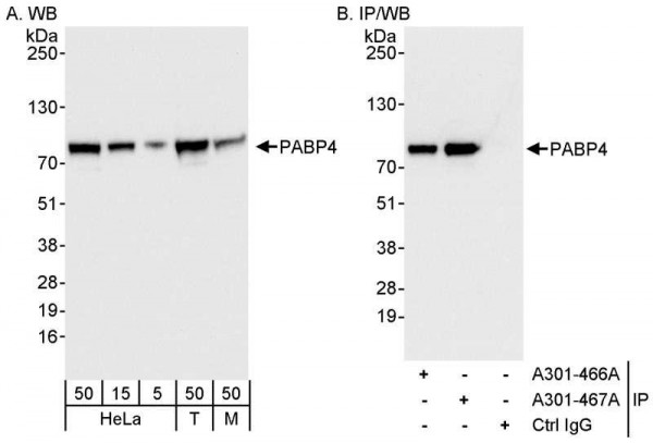 Anti-PABP4