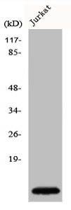 Anti-CKS1B