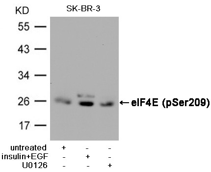 Anti-phospho-eIF4E (Ser209)