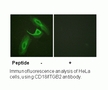 Anti-CD18/ITGB2 (Ab-758)