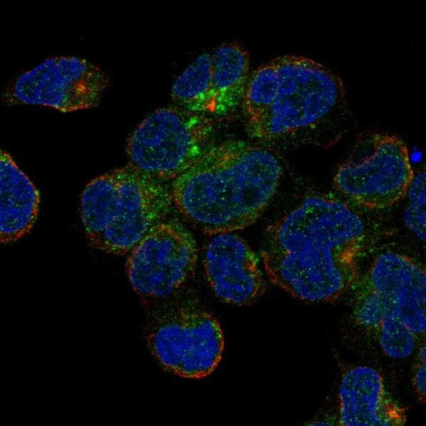 Anti-CD1C