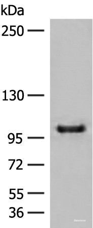 Anti-CTDP1