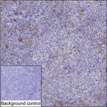 Anti-CD40L