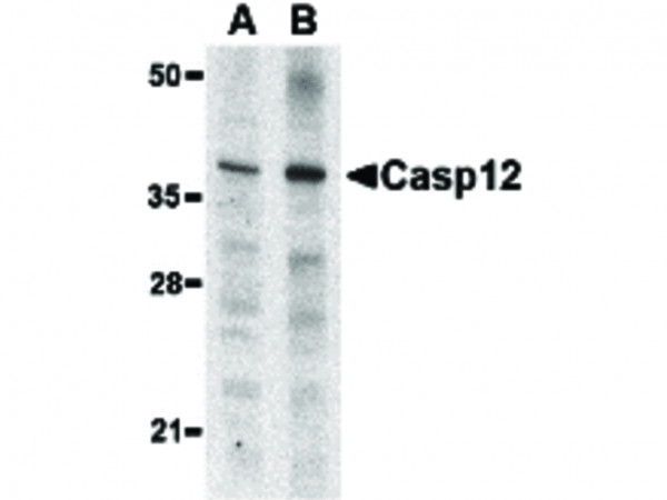 Anti-Caspase-12 (Small)(RABBIT)