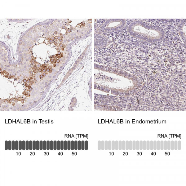 Anti-LDHAL6B