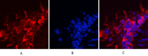 Anti-HSP90AB1