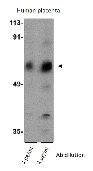 Anti-ACVR1C / ALK7