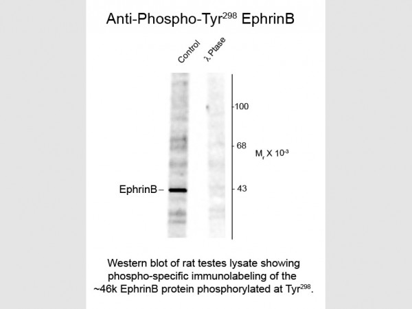 Anti-phospho-EphrinB (Thr298)