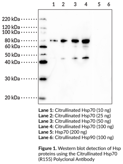Anti-Citrullinated Hsp70 (R155)