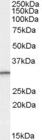 Anti-PSME1 (isoform 1), C-terminal