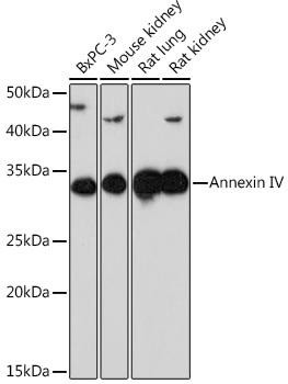 Anti-Annexin A4/Annexin IV