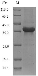 Alpha/beta hydrolase domain-containing protein 11 (Abhd11), mouse, recombinant