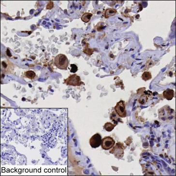 Anti-Actin Regulatory Protein CAPG