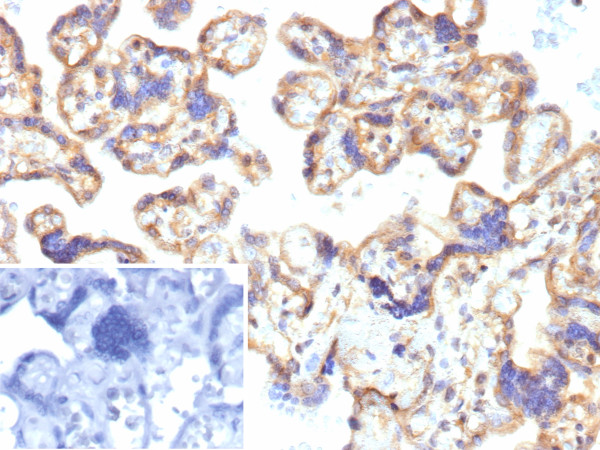 Anti-CD39 / ENTPD1 (Marker of Tumor-specific T cells), recombinant antibody, clone r22A9
