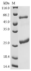 Isoleucine--tRNA ligase, cytoplasmic (IARS),partial, human, recombinant