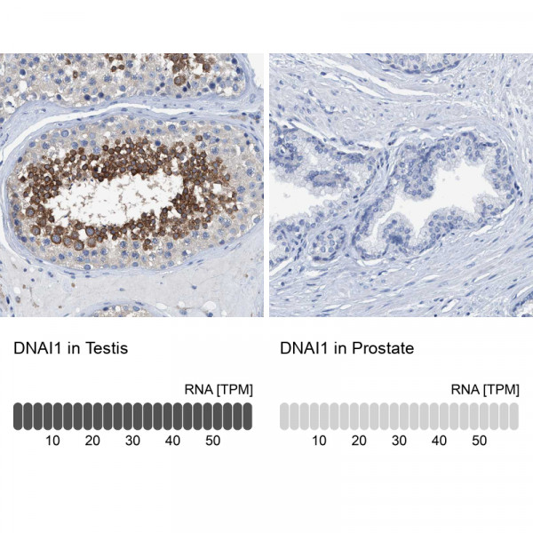 Anti-DNAI1