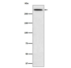 Anti-SPTA1 / Spectrin alpha 1, clone AFGF-19