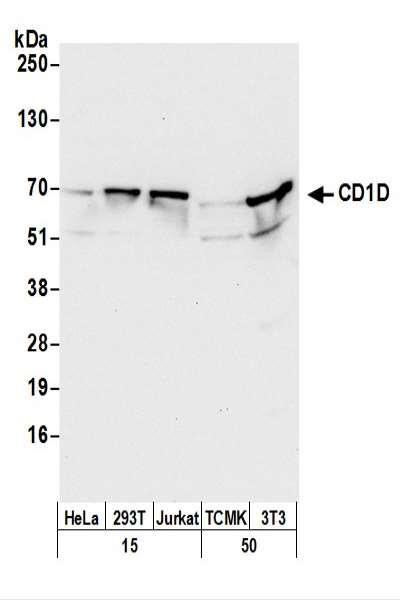 Anti-CD1D