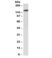 Anti-SP140