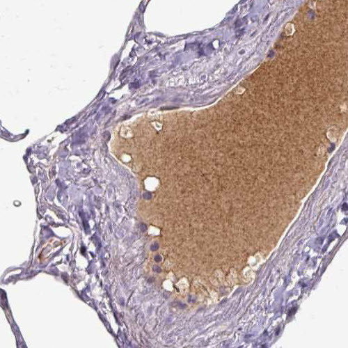 Anti-APOL1, clone CL0171