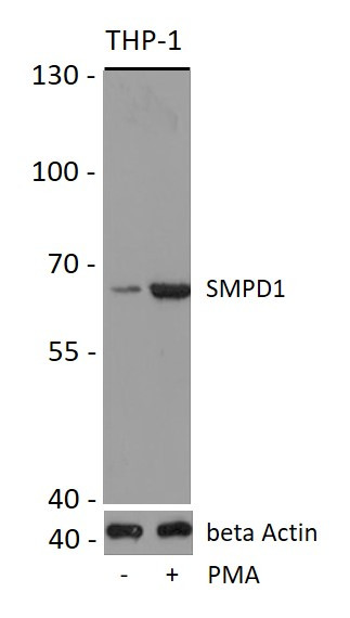 Anti-SMPD1 / Acid Sphingomyelinase