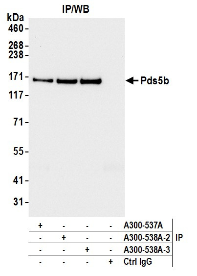 Anti-Pds5B