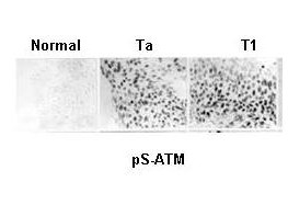 Anti-phospho-ATM Protein Kinase (Ser1981), clone 7C10D8