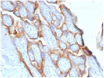 Anti-HCG-beta (Pregnancy &amp; Choriocarcinoma Marker) Recombinant Rabbit Monoclonal Antibody (clone:HCG