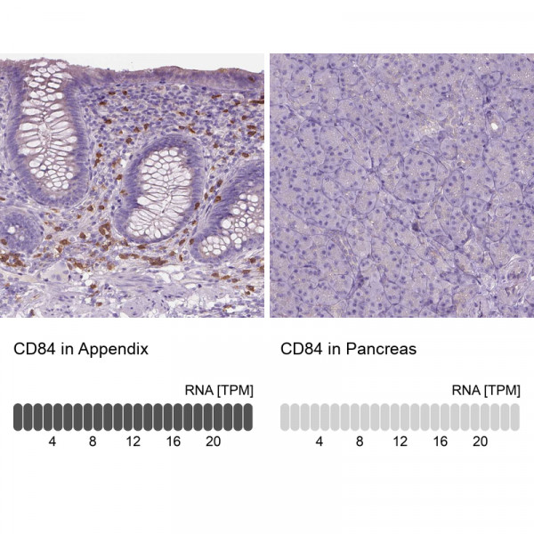 Anti-CD84