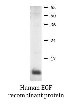 Human EGF recombinant protein (Active)