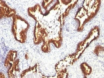 Anti-Cytokeratin 18, clone KRT18/1190