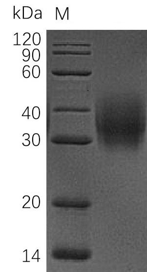 Leukocyte surface antigen CD47 (CD47), partial (Active), human, recombinant