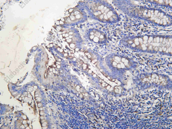 Anti-Recombinant CEACAM1, clone C112435