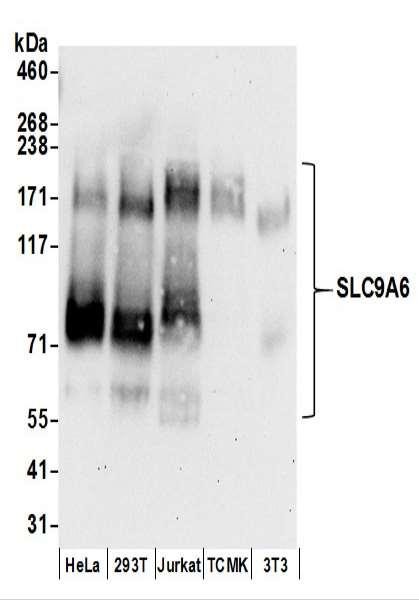 Anti-SLC9A6