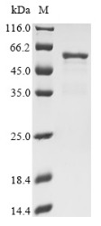 Nucleosome assembly protein 1-like 4 (NAP1L4), human, recombinant