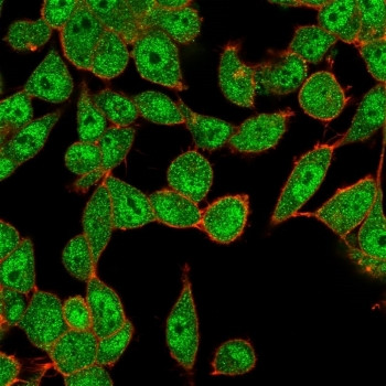 Anti-Ubiquitin-conjugating enzyme E2 B / UBE2B, clone PCRP-UBE2B-1C7