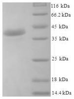 Josephin-1 (JOSD1), human, recombinant