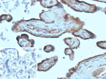 Anti-FOLR1 / Folate receptor 1, clone FOLR1/13424R