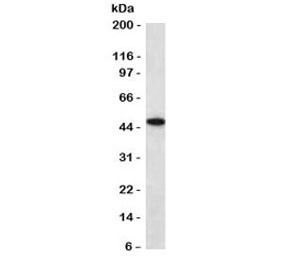 Anti-Cytokeratin 18, clone CTKN18-2R