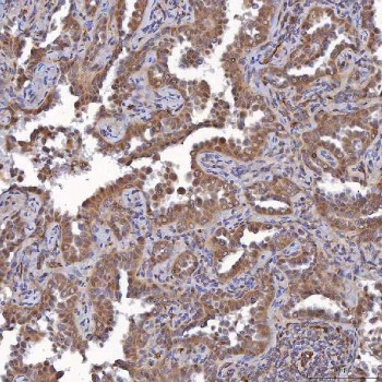 Anti-SAV1 / Protein salvador homolog 1 / WW45