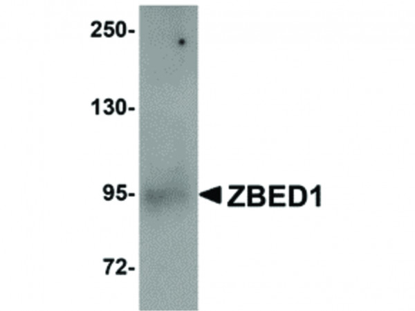 Anti-ZBED1